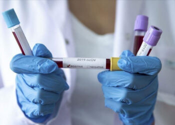 Қазақстанда бір тәулікте 2579 адамнан коронавирус анықталды